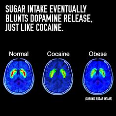 Sugar Is The&nbsp;Devil